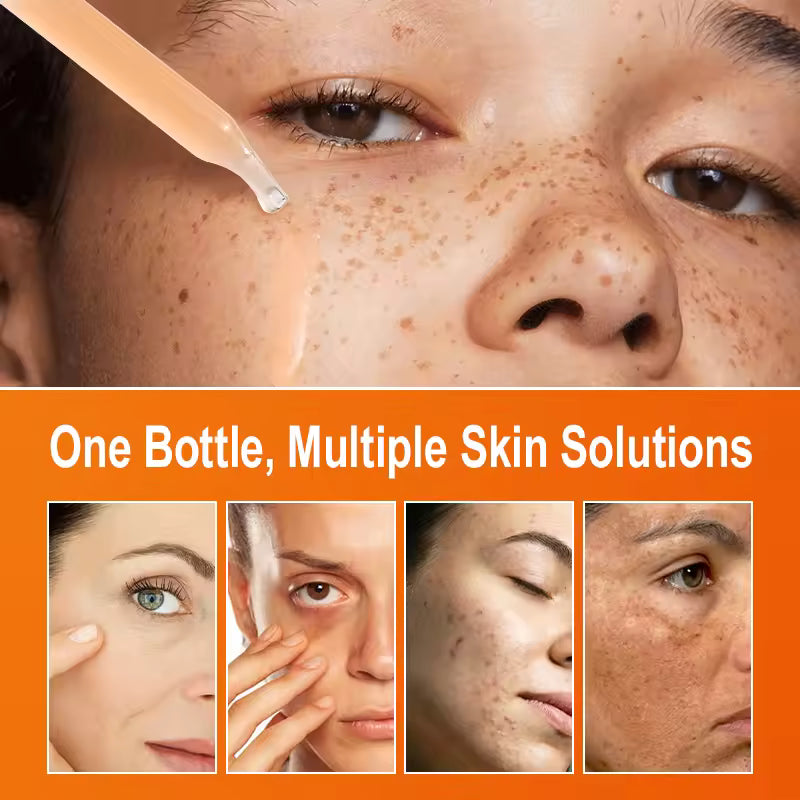 Vitamin C Serum for Dark Spots and Glow